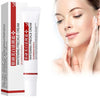 Advanced Effective Whitening & Freckle Removal Cream for Radiant Skin